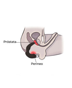 Alternative view of Peutirt masajeador prostático recargable
