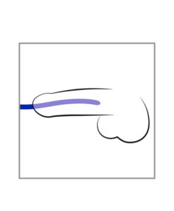 Alternative view of Pack 3 dilatadores uretrales de silicona unisex