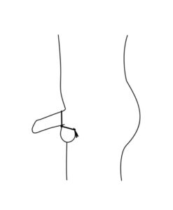 Alternative view of Forge Double anillo doble potenciador ajustable